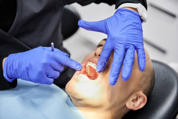 Best Emergency Tooth Extraction in Hickman, KY