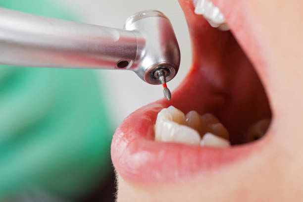 Best Emergency Denture Repair in Hickman, KY